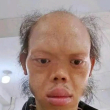 ͷ��