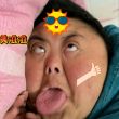 ͷ��