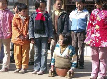 中国球阀4岁截肢靠女孩落泪,15还是全世界开启手动走路阀门年前篮球闸阀图片