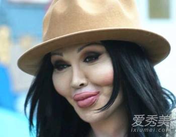 韩国女星鼻子当场塌陷!整容失败惨不忍睹的女